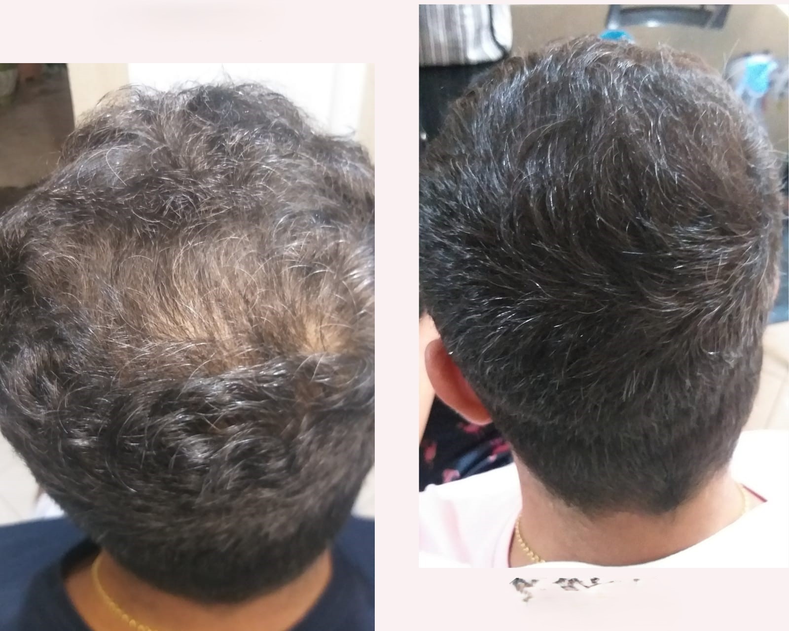 Antes e depois Wlisses2